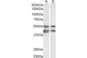 Image no. 1 for anti-E2F Transcription Factor 4, P107/p130-Binding (E2F4) antibody (ABIN5900178) (E2F4 抗体)