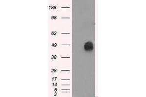 HEK293T cells were transfected with the pCMV6-ENTRY control (Left lane) or pCMV6-ENTRY ERCC1 (Right lane) cDNA for 48 hrs and lysed. (ERCC1 抗体)