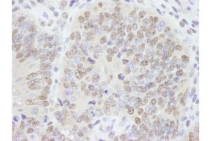 Immunohistochemistry (IHC) image for anti-A Kinase (PRKA) Anchor Protein 8 (AKAP8) (C-Term) antibody (ABIN7448405)