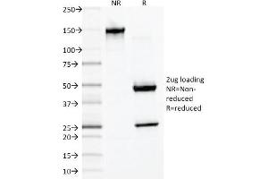 SDS-PAGE Analysis of Purified Desmin Monoclonal Antibody (DES/1711). (Desmin 抗体)