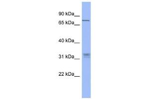 WB Suggested Anti-PRDM8 Antibody Titration:  0. (PRDM8 抗体  (Middle Region))