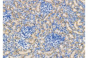 ABIN6261181 and ABIN6278835 at 1/100 staining Rat kidney tissue by IHC-P. (COX3 抗体  (Internal Region))
