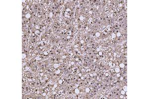 IHC analysis of TRIR using anti-TRIR antibody (ABIN7603244). (Uncharacterized Protein C19orf43 (TRIR) (N-Term) 抗体)