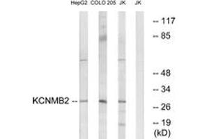 Western blot analysis of extracts from Jurkat/COLO/HepG2 cells, using KCNMB2 Antibody. (KCNMB2 抗体  (AA 151-200))