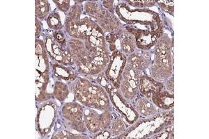 Immunohistochemical staining of human kidney with NARFL polyclonal antibody  shows strong cytoplasmic positivity in distal tubules at 1:200-1:500 dilution. (NARFL 抗体)