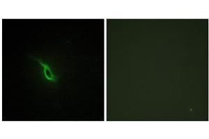 Immunofluorescence analysis of NIH/3T3 cells, using Adrenergic Receptor alpha -2A antibody. (ADRA2A 抗体  (C-Term))