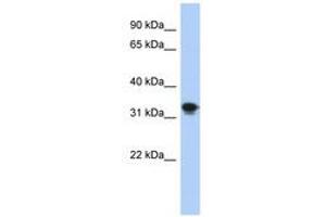 Image no. 1 for anti-Centromere Protein P (CENPP) (AA 35-84) antibody (ABIN6741259)