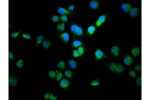 Immunofluorescence staining of Hela cells with ABIN7165976 at 1:100, counter-stained with DAPI. (SSH1 抗体  (AA 928-1049))