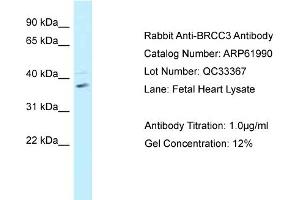 Western Blotting (WB) image for anti-BRCA1/BRCA2-Containing Complex, Subunit 3 (BRCC3) (C-Term) antibody (ABIN2788976) (BRCC3 抗体  (C-Term))