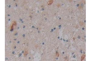 Immunohistochemistry (IHC) image for anti-Nitric Oxide Synthase Trafficker (NOSTRIN) (AA 18-251) antibody (ABIN7432253)
