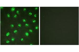 Immunofluorescence analysis of HuvEc cells, using p57 Kip2 (Ab-310) Antibody. (CDKN1C 抗体  (AA 267-316))