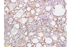 Formalin-fixed and paraffin embedded: rat liver labeled with Anti-Leptin Polyclonal Antibody (ABIN725030), Unconjugated 1:300 followed by conjugation to the secondary antibody and DAB staining (Leptin 抗体  (AA 101-154))