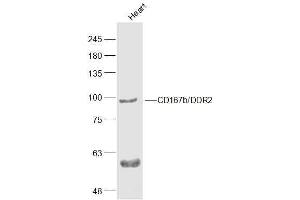 Mouse Heart lysates probed with CD167b'DDR2 Polyclonal Antibody, Unconjugated  at 1:500 dilution and 4˚C overnight incubation. (DDR2 抗体  (AA 245-350))