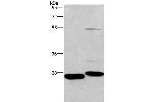 Western Blot analysis of Mouse intestinum tenue and heart tissue using CIDEC Polyclonal Antibody at dilution of 1:551 (CIDEC 抗体)