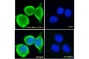 ABIN185461 Immunofluorescence analysis of paraformaldehyde fixed MCF7 cells, permeabilized with 0.