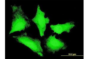 Immunofluorescence of monoclonal antibody to PIBF1 on HeLa cell. (PIBF1 抗体  (AA 660-755))