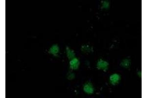 Anti-DSTN mouse monoclonal antibody (ABIN2454364) immunofluorescent staining of COS7 cells transiently transfected by pCMV6-ENTRY DSTN (RC203419). (Destrin 抗体)