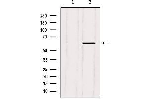 Western blot analysis of extracts from Mouse brain, using Tyrosine Hydroxylase Antibody.