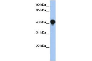 WB Suggested Anti-PTPLAD1 Antibody Titration:  0. (PTPLAD1 抗体  (N-Term))