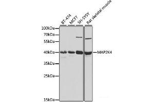 Western blot analysis of extracts of various cell lines using MAP2K4 Polyclonal Antibody at dilution of 1:1000. (MAP2K4 抗体)