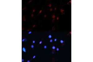 Immunofluorescence analysis of C6 using ZEB1 antibody (ABIN6129933, ABIN6150422, ABIN6150423 and ABIN6221237) at dilution of 1:100 (40x lens).