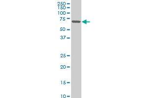 ZNF215 monoclonal antibody (M02), clone 1E4 Western Blot analysis of ZNF215 expression in A-431 . (ZNF215 抗体  (AA 1-304))