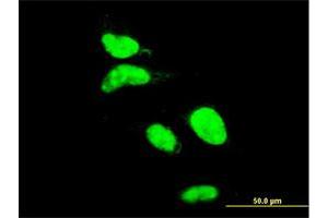Immunofluorescence of monoclonal antibody to AATF on HeLa cell. (AATF 抗体  (AA 151-250))