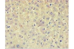Immunohistochemistry of paraffin-embedded human liver tissue using ABIN7143031 at dilution of 1: 100 (AFAP 抗体  (AA 461-730))