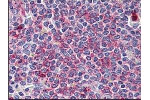 Immunohistochemistry: WNT5B antibody staining of Formalin-Fixed, Paraffin-Embedded Human Spleen.