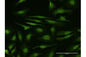 Immunofluorescence of purified MaxPab antibody to SMAD6 on HeLa cell. (SMAD6 抗体  (AA 1-496))