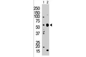 The PACSIN2 polyclonal antibody  is used in Western blot to detect PACSIN2 in T-47D cell lysate (Lane 1) and mouse brain tissue lysate (Lane 2) . (PACSIN2 抗体  (C-Term))