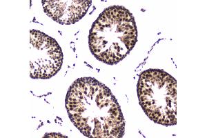 IHC analysis of POLR2A using anti-POLR2A antibody . (POLR2A/RPB1 抗体  (AA 1148-1384))