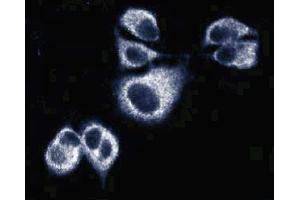 Immunofluorescence of AN3 CA cells (Human endometrial adenocarcinoma, ATCC HTB-111). (Sec8 抗体  (AA 31-201))