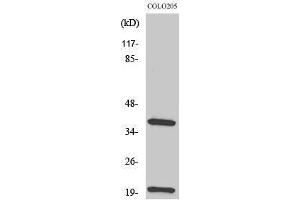Western Blotting (WB) image for anti-T Cell Receptor (TCR) beta (TCR beta) (Internal Region) antibody (ABIN3180910) (TCR beta 抗体  (Internal Region))