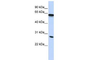 IGSF1 antibody used at 1 ug/ml to detect target protein. (IGSF1 抗体  (Middle Region))