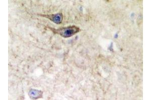 Immunohistochemistry analyzes of EphB1/2 antibody in paraffin-embedded human brain tissue. (EPH Receptor B1 抗体)