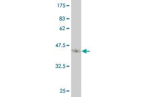 Western Blot detection against Immunogen (37. (STMN2 抗体  (AA 73-179))