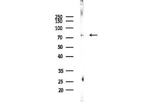Western blot analysis of lysates from Mouse lung, using RBM35B Antibody at 1/1000 dilution.