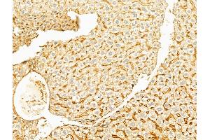 ABIN6256124 and ABIN6267537 at 1/100 staining Mouse liver tissue by IHC-P. (YAP1 抗体  (pSer127))