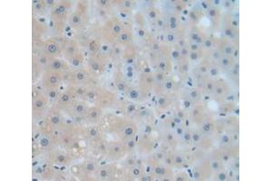 IHC-P analysis of Human Tissue, with DAB staining. (Complement Factor B 抗体  (AA 477-600))