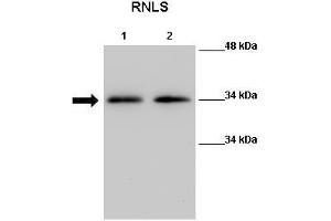 WB Suggested Anti-Rnls Antibody  Positive Control: Lane 1:441 µg Mouse kidney tissue lysate Lane 2: 041 µg Mouse kidney tissue lysate Primary Antibody Dilution: 1:000Secondary Antibody: Anti-rabbit-HRP Secondry  Antibody Dilution: 1:0500Submitted by: Nitish R Mahapatra, IIT Madras (RNLS 抗体  (Middle Region))