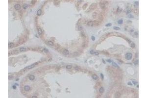 Immunohistochemistry (IHC) image for anti-ATP Synthase, H+ Transporting, Mitochondrial F0 Complex, Subunit F6 (ATP5J) (AA 1-108) antibody (ABIN7441733)