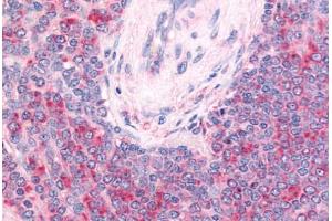 Human Spleen, Central Artery and Lymphocytes Within Periarteriolar Lymphoid Sheaths (formalin-fixed, paraffin-embedded) stained with c-Kit antibody ABIN213610 at 20 ug/ml followed by biotinylated goat anti-rabbit IgG secondary antibody ABIN481713, alkaline  . (KIT 抗体  (Extracellular Domain))