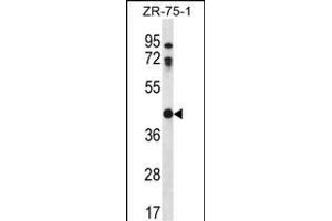 CTSO Antibody (N-term) (ABIN656692 and ABIN2845928) western blot analysis in ZR-75-1 cell line lysates (35 μg/lane). (CTSO 抗体  (N-Term))
