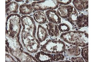 Image no. 1 for anti-NADH Dehydrogenase (Ubiquinone) 1 beta Subcomplex, 10, 22kDa (NDUFB10) antibody (ABIN1499668) (NDUFB10 抗体)