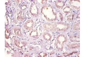 Immunohistochemistry of paraffin-embedded human kidney tissue using ABIN7149627 at dilution of 1:100 (DHRS9 抗体  (AA 23-319))