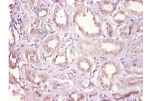 Immunohistochemistry of paraffin-embedded human kidney tissue using ABIN7149627 at dilution of 1:100 (DHRS9 抗体  (AA 23-319))