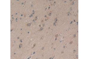 Used in DAB staining on fromalin fixed paraffin- embedded Kidney tissue (Neurocan 抗体  (AA 1008-1273))