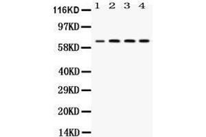 Western blot analysis of YY1 expression in rat lung extract (lane 1), JURKAT whole cell lysates (lane 2), CEM whole cell lysates (lane 3) and HEPG2 whole cell lysates (lane 4). (YY1 抗体  (Middle Region))