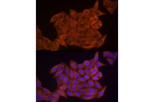Immunofluorescence (IF) image for anti-Thymidine Kinase 1, Soluble (TK1) (AA 1-234) antibody (ABIN6149198)